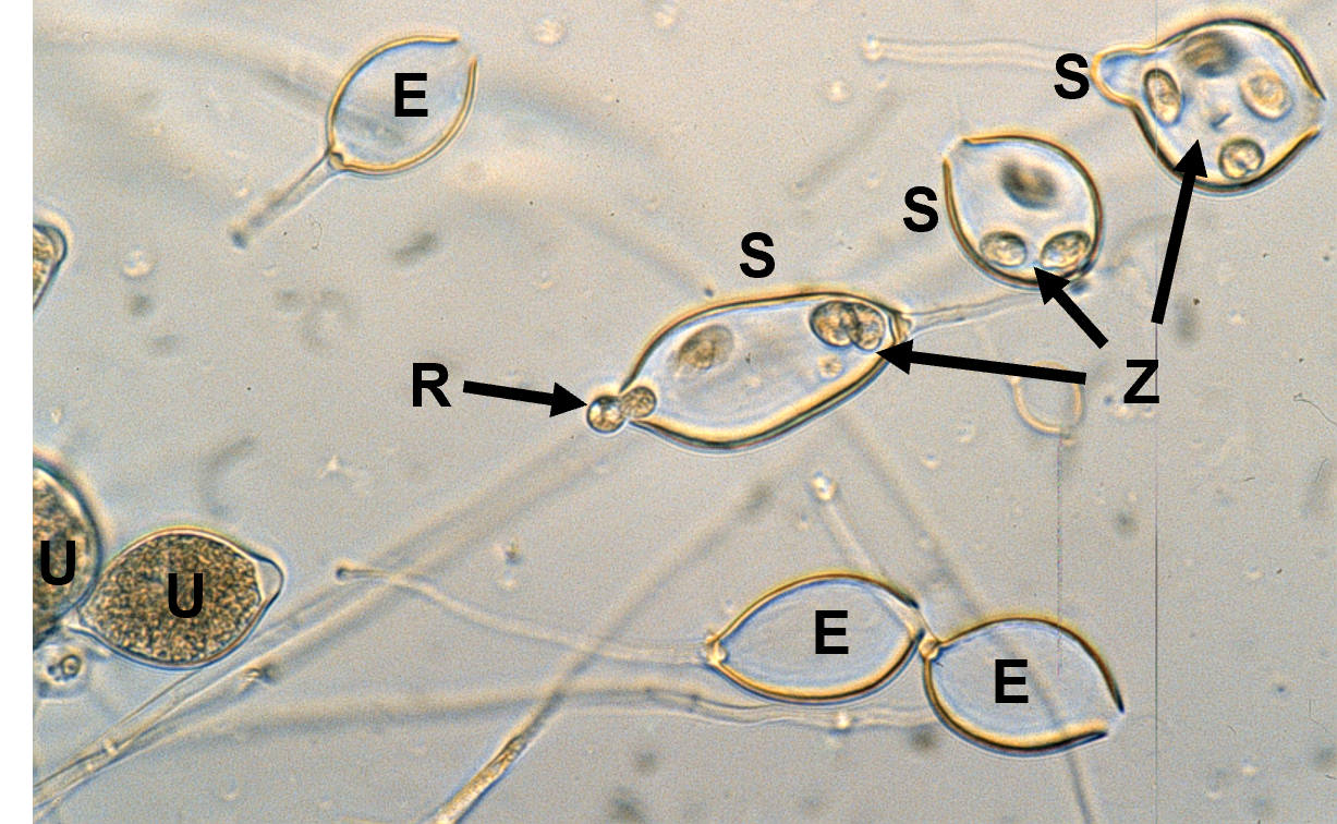 Phytophthora under a microscope.